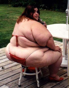 Tiedosto:Obese-woman.jpg